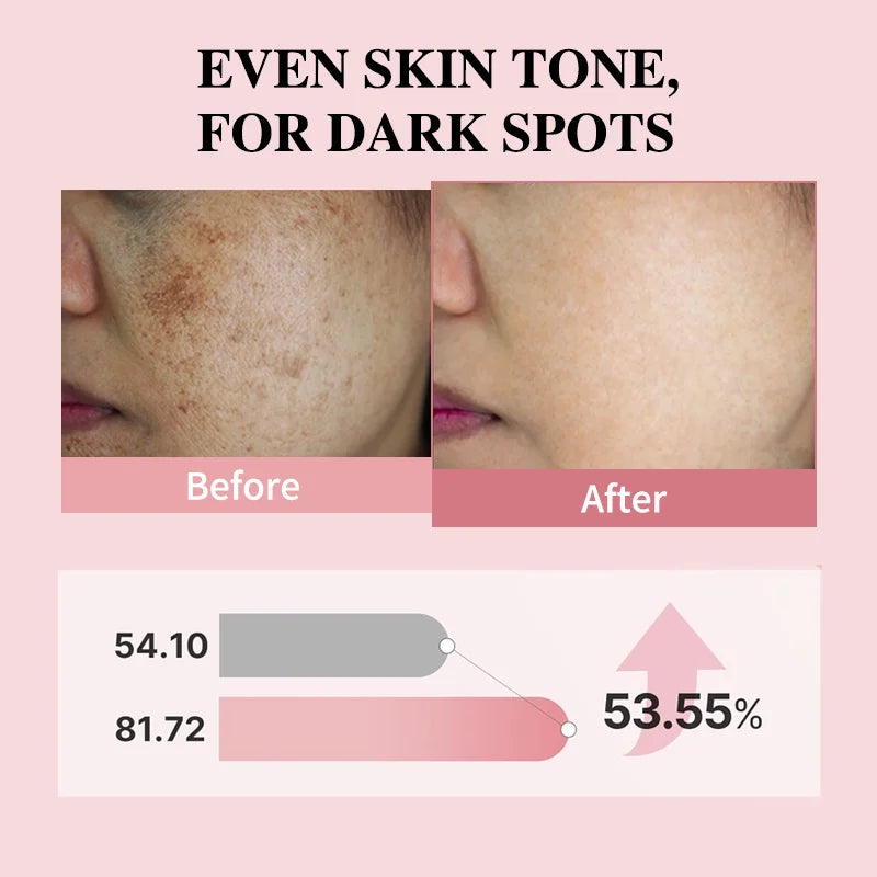 Before and after comparison of skin tone with dark spots reduction